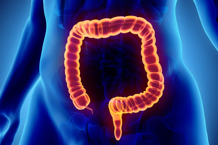 Illustrasjon av tarm