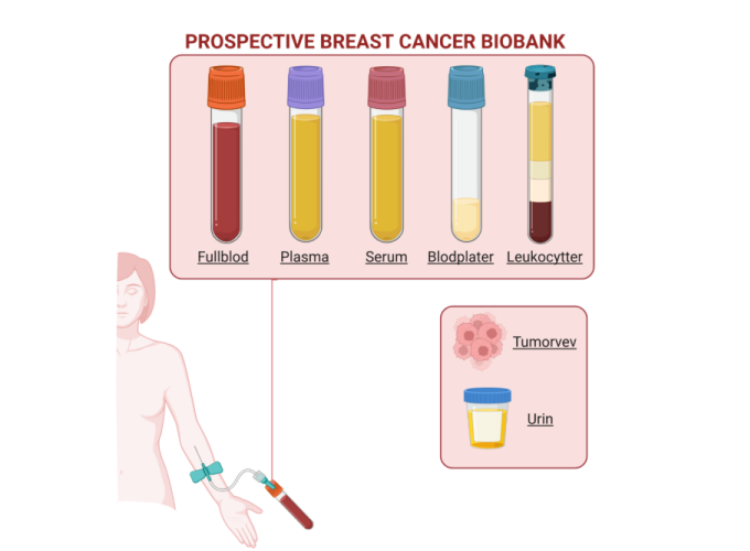 Prospective Breast Cancer Biobank: Blodprøvetaking (fullblod. plasma, serum, blodplater, leukocytter, tumor vev, urin)
