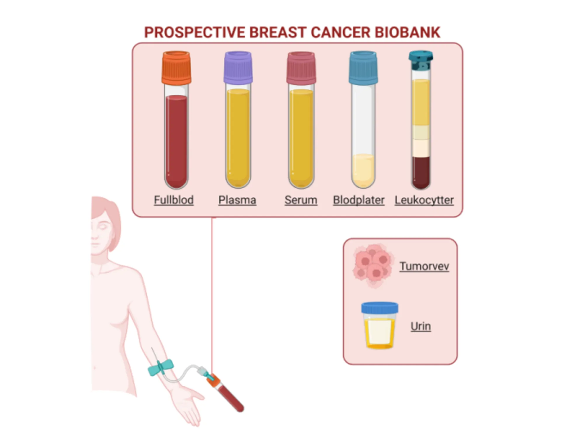 Prospective Breast Cancer Biobank: Blodprøvetaking (fullblod. plasma, serum, blodplater, leukocytter, tumor vev, urin)