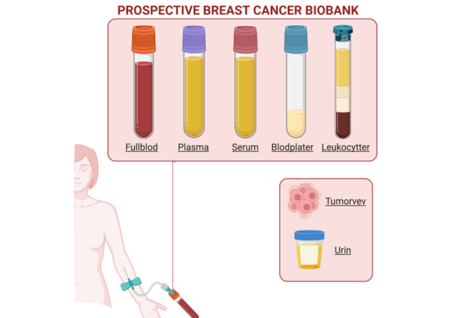 Prospective Breast Cancer Biobank: Blodprøvetaking (fullblod. plasma, serum, blodplater, leukocytter, tumor vev, urin)