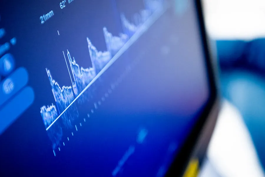 Et nærbilde av en dataskjerm