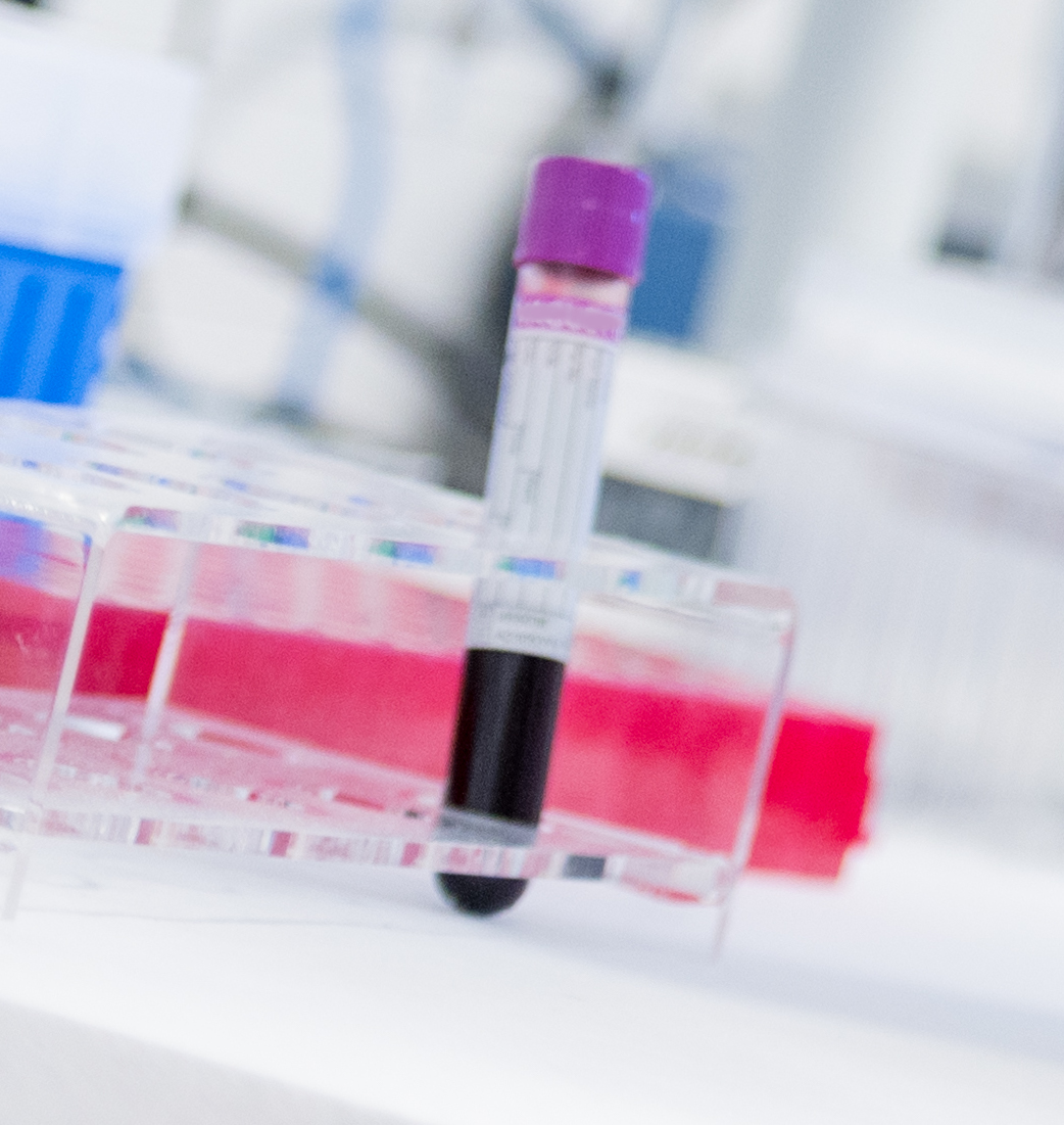 Et nærbilde av en handlekurv