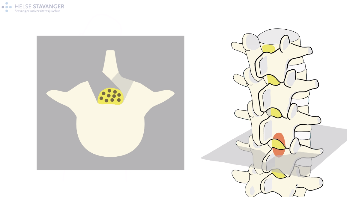 Skjermbilde fra film