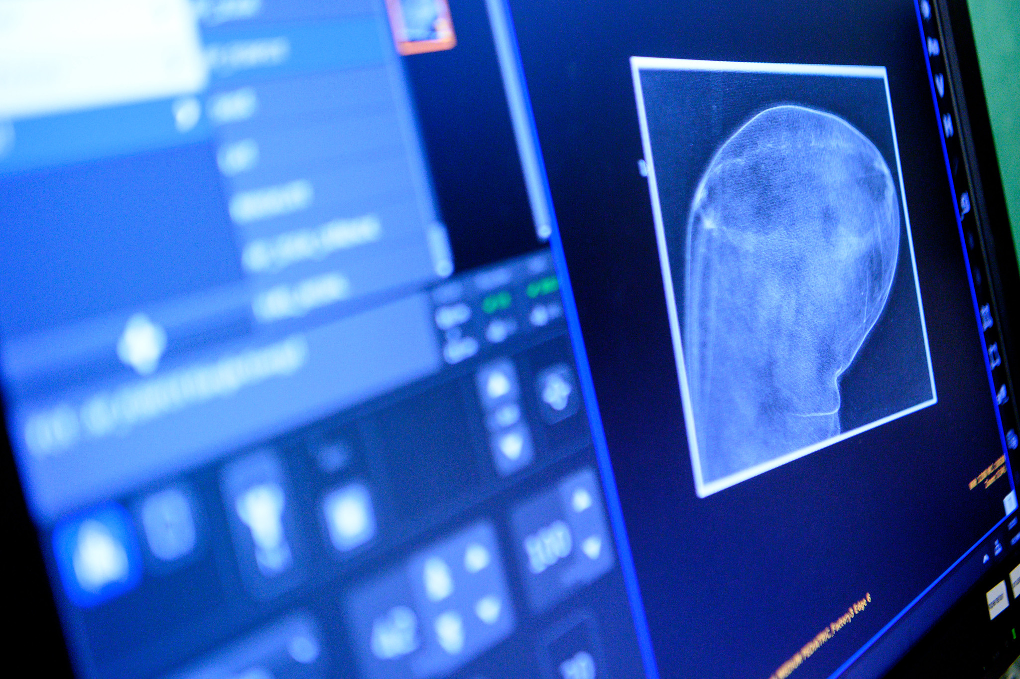 Et nærbilde av et nettbrett