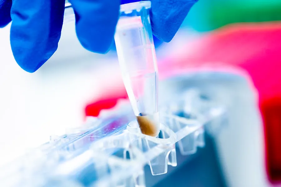 En person som holder labutstyr