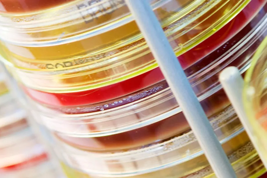 Et nærbilde av flere målebegre