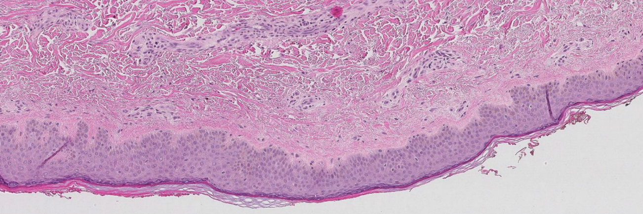 Nærbilde av en vevsprøve.