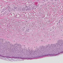 Nærbilde av en vevsprøve.