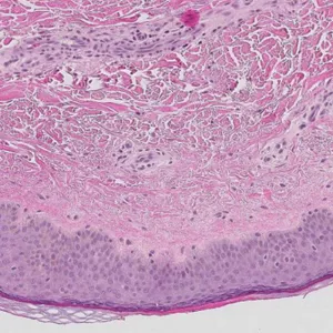 Nærbilde av en vevsprøve.