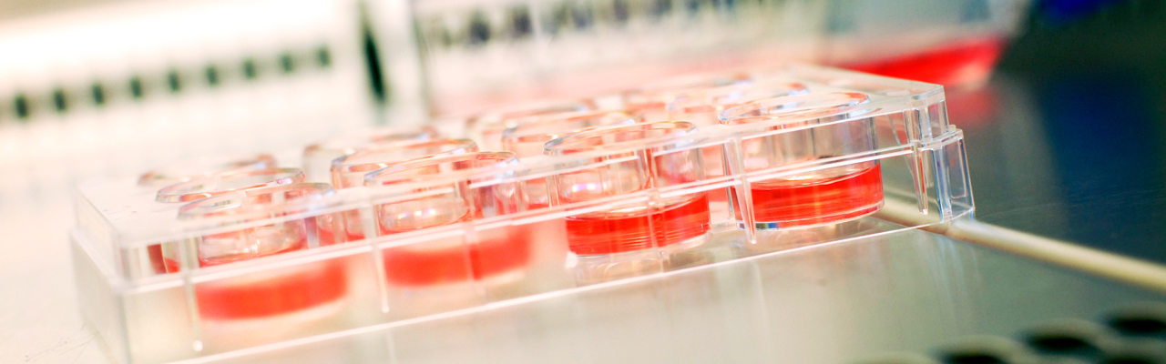 Prøver fra laboratoriene. Foto.