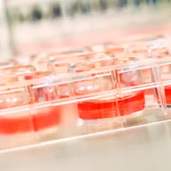 Prøver fra laboratoriene. Foto.