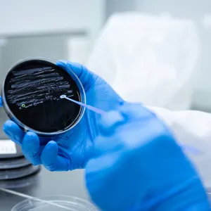 legionella agar skål