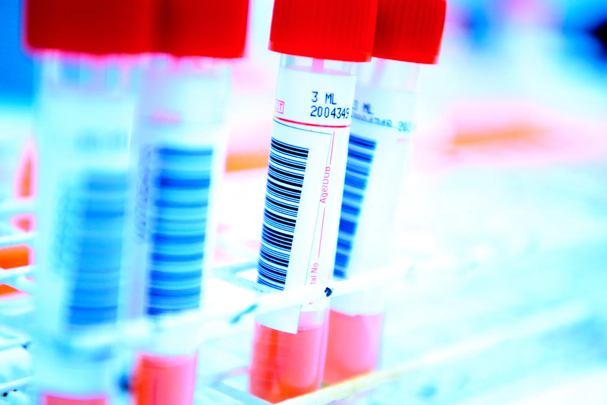 Pasientprøver til undersøkelse for koronavirus (SARS-CoV-2).