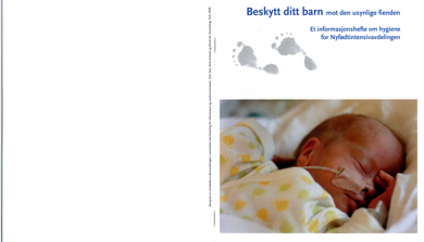 Baby med slange gjennom nesen.