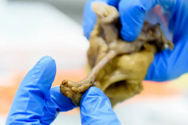 Blåkledde fingre holder opp en bit av en tarm.